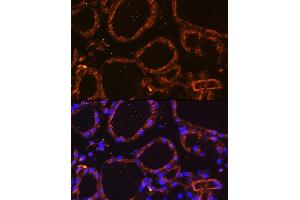 Immunofluorescence analysis of Mouse thyroid using WNT5A Rabbit pAb (ABIN6134458, ABIN6150248, ABIN6150249 and ABIN6216485) at dilution of 1:100. (WNT5A Antikörper  (AA 250-350))