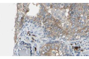 ABIN6274616 at 1/100 staining Human prostate tissue by IHC-P. (CDCA3 Antikörper  (C-Term))
