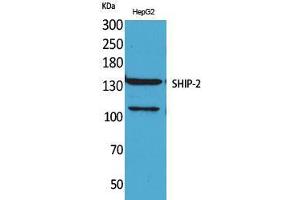 Western Blot (WB) analysis of HepG2 cells using SHIP-2 Polyclonal Antibody. (INPPL1 Antikörper  (Internal Region))