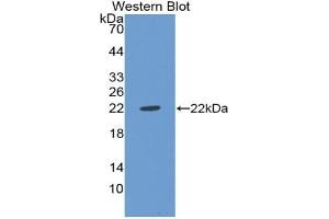 Detection of Recombinant vWF, Rat using Polyclonal Antibody to Von Willebrand Factor (vWF) (VWF Antikörper  (AA 49-230))