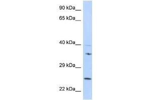 GRB2 Antibody - N-terminal region (ARP58474_P050) validated by WB using 721_B cell Lysate at 1 µg/mL.