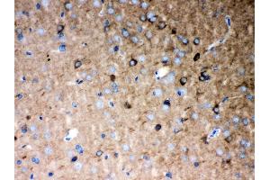 Immunohistochemistry (IHC) image for anti-Purinergic Receptor P2X, Ligand-Gated Ion Channel, 5 (P2RX5) (AA 333-422) antibody (ABIN3043894)