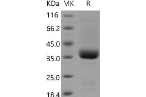 Western Blotting (WB) image for Interleukin 9 Receptor (IL9R) protein (His tag) (ABIN7321224) (IL9 Receptor Protein (His tag))