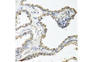 Immunohistochemistry of paraffin-embedded human prostate using COLEC11 antibody (ABIN6130117, ABIN6138854, ABIN6138855 and ABIN6220812) at dilution of 1:100 (40x lens). (COLEC11 Antikörper  (AA 26-271))