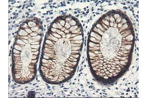 Immunohistochemical staining of paraffin-embedded Human colon tissue using anti-NAPEPLD mouse monoclonal antibody. (NAPEPLD Antikörper)