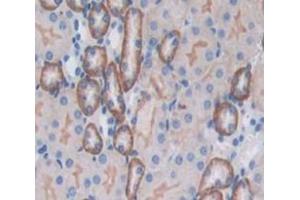 Used in DAB staining on fromalin fixed paraffin- embedded Kidney tissue (CD164 Antikörper  (AA 24-162))