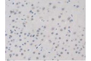 IHC-P analysis of Mouse Brain Tissue, with DAB staining. (BRD8 Antikörper  (AA 797-951))
