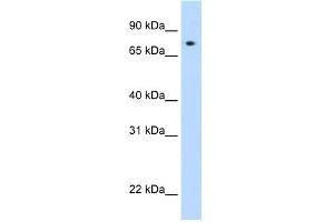 WB Suggested Anti-STAT1 Antibody Titration: 0. (STAT1 Antikörper  (N-Term))
