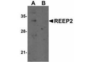 Image no. 1 for anti-Receptor Accessory Protein 2 (REEP2) (Internal Region) antibody (ABIN478103) (REEP2 Antikörper  (Internal Region))