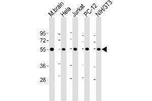 All lanes : Anti-beta II Tubulin at 1:8000 dilution Lane 1: mouse brain lysate Lane 2: Hela whole cell lysate Lane 3: Jurkat whole cell lysate Lane 4: PC-12 whole cell lysate Lane 5: NIH/3T3 whole cell lysate Lysates/proteins at 20 μg per lane. (TUBB2A Antikörper  (AA 14-46))