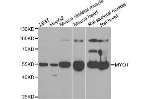Western blot analysis of extracts of various cell lines, using MYOT antibody (ABIN5973839) at 1/1000 dilution. (Myotilin Antikörper)