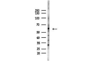 Western blot analysis of lysates from HepG2 cells(starvation,24h treatment), using Phospho-p53 (Ser37) Antibody at 1/1000 dilution.