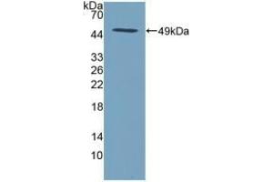 Detection of Recombinant SPINT2, Human using Polyclonal Antibody to Serine Peptidase Inhibitor Kunitz Type 2 (SPINT2) (SPINT2 Antikörper  (AA 28-197))