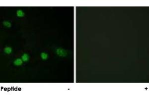 Immunofluorescence analysis of HeLa cells, using RAF1 polyclonal antibody . (RAF1 Antikörper)