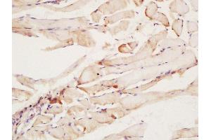 Formalin-fixed and paraffin embedded rat muscle labeled with Rabbit Anti-CNTF Receptor alpha Polyclonal Antibody at 1:200 followed by conjugation to the secondary antibody and DAB staining