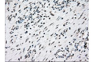 Immunohistochemical staining of paraffin-embedded lung tissue using anti-NRBP1mouse monoclonal antibody.