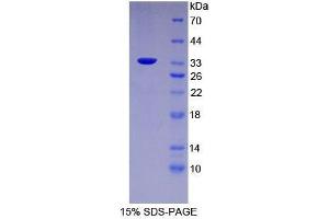 SDS-PAGE analysis of Mouse FUCa1 Protein.