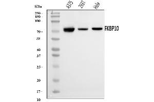 Western blot analysis of FKBP10 using anti-FKBP10 antibody (ABIN7601140).