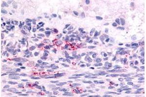 Immunohistochemical staining of human ovary, graafian follicle with LPHN2 polyclonal antibody . (LPHN2 Antikörper  (N-Term))