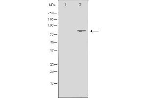 Western blot analysis of Jurkat whole cell lysates, using MRE11A Antibody. (Mre11 Antikörper  (C-Term))