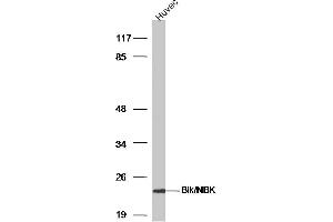 HUVEC lysates probed with Bik/NBK Polyclonal Antibody, Unconjugated  at 1:300 dilution and 4˚C overnight incubation. (BIK Antikörper  (AA 10-90))