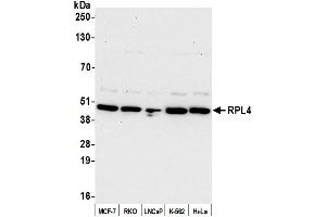 anti-Ribosomal Protein L4 (RPL4) (AA 377-427) antibody