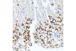 Immunohistochemistry of paraffin-embedded mouse stomach using GPM6A antibody. (GPM6A Antikörper)
