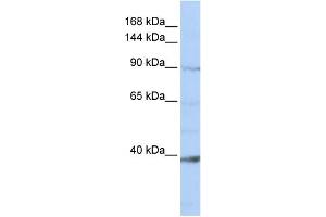 WB Suggested Anti-NCKAP1L Antibody Titration:  0. (NCKAP1L Antikörper  (N-Term))
