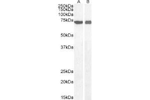 ABIN2560986 (0. (AIF Antikörper)