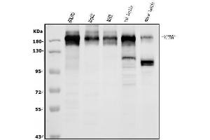 Western blot analysis of VPRBP/DCAF1 using anti-VPRBP/DCAF1 antibody (ABIN7599063). (DDB1 and CUL4-Associated Factor 1 (DCAF1) (AA 1-195) Antikörper)