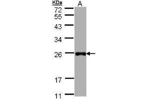 WB Image Sample (30 ug of whole cell lysate) A: Hep G2 , 12% SDS PAGE antibody diluted at 1:1000 (LITAF Antikörper)
