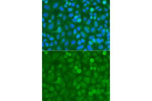 Immunofluorescence analysis of A549 cells using NCK1 antibody. (NCK1 Antikörper)
