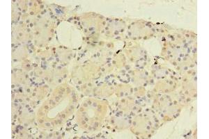 Immunohistochemistry of paraffin-embedded human pancreatic tissue using ABIN7148768 at dilution of 1:100 (CWF19L1 Antikörper  (AA 101-330))