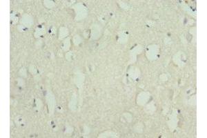 Immunohistochemistry of paraffin-embedded human brain tissue using ABIN7157650 at dilution of 1:100 (KIF3A Antikörper  (AA 430-699))