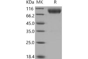 Western Blotting (WB) image for CD200 Receptor 1 (CD200R1) (Active) protein (His tag,Fc Tag) (ABIN7320365)