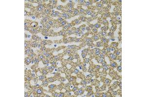 Immunohistochemistry of paraffin-embedded rat liver using EPO antibody. (EPO Antikörper)