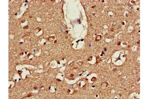 Immunohistochemistry of paraffin-embedded human brain tissue using ABIN7164586 at dilution of 1:100 (ATP9A Antikörper  (AA 2-69))
