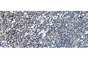 Immunohistochemistry of paraffin-embedded Human tonsil tissue using UGT8 Polyclonal Antibody at dilution of 1:55(x200) (UGT8 Antikörper)