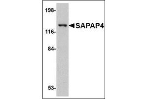 Western blot analysis of SAPAP4 in SK-N-SH cell lysate with this product at 1 μg/ml. (DLGAP4 Antikörper  (Center))