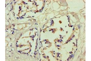 Immunohistochemistry of paraffin-embedded human prostate tissue using ABIN7152936 at dilution of 1:100 (Filaggrin Antikörper  (AA 3838-4061))