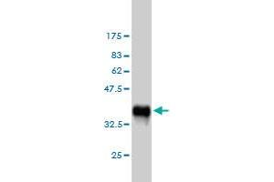 Phospholipase C gamma 1 Antikörper  (AA 1192-1291)