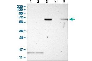 Western Blot analysis with JPH1 polyclonal antibody . (Junctophilin 1 Antikörper  (AA 528-629))
