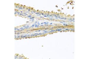 Immunohistochemistry of paraffin-embedded human prostate using PIP antibody (ABIN5973796) at dilution of 1/100 (40x lens). (PIP Antikörper)