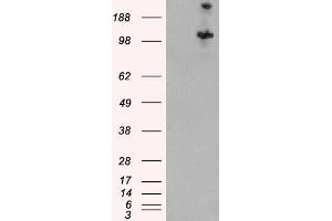 Western Blotting (WB) image for anti-Tuberous Sclerosis 1 (TSC1) antibody (ABIN5868148) (TSC1 Antikörper)