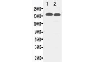 Anti-TJP2 antibody, Western blotting Lane 1: 293T Cell Lysate Lane 2: MCF-7 Cell Lysate (TJP2 Antikörper  (C-Term))