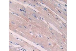 Immunohistochemistry (IHC) image for anti-Natriuretic Peptide A (NPPA) (AA 25-152) antibody (ABIN1172615)