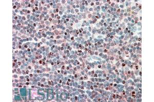 ABIN571002 (5µg/ml) staining of paraffin embedded Human Tonsil. (PSMB10 Antikörper  (Internal Region))