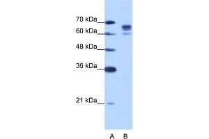 WB Suggested Anti-DDX17 Antibody Titration:  1. (DDX17 Antikörper  (N-Term))