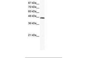 Image no. 1 for anti-Enolase 1 (ENO1) (C-Term) antibody (ABIN202519) (ENO1 Antikörper  (C-Term))