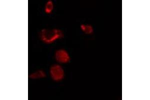 ABIN6272411 staining NIH-3T3 by IF/ICC. (RBM34 Antikörper  (C-Term))